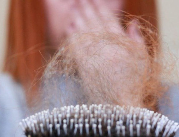 cropped-queda-de-cabelo-causa.jpg